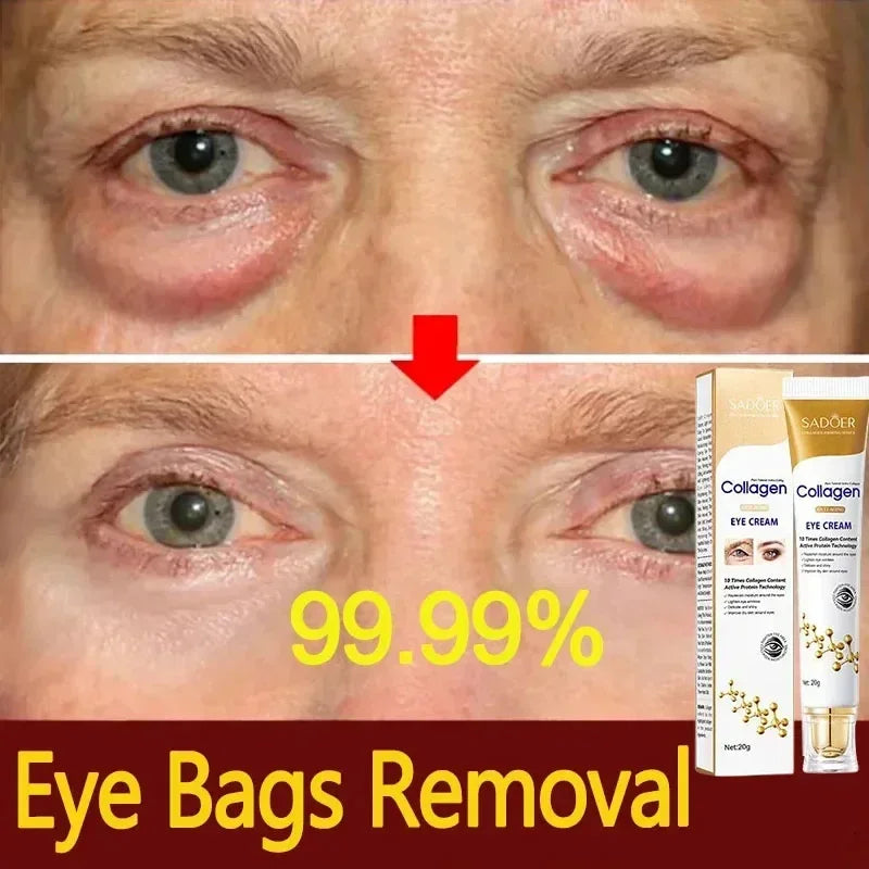 Fast-Acting Eye Bag Removal Cream Collagen Anti-Wrinkle Firming Fade Fine Lines Dark Circles Remove Eye Bags Brighten Eye Care